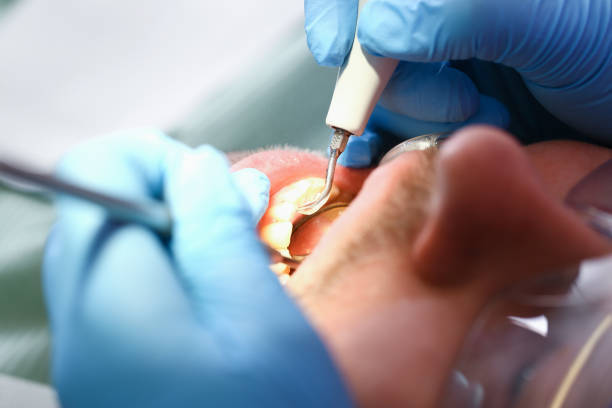 Best Broken or Chipped Tooth Repair in Lac Du Flambeau, WI