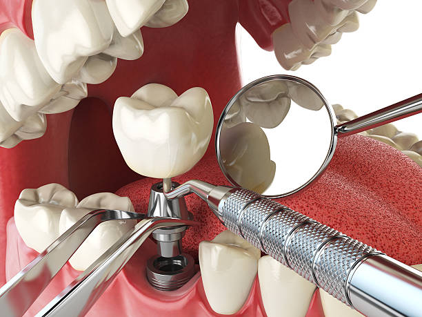 Best Urgent Dental Care for Toothaches in Lac Du Flambeau, WI