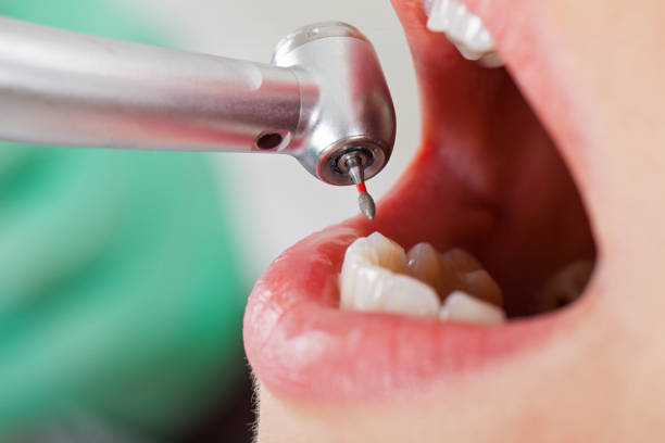 Professional Emergency Dental Service in WI